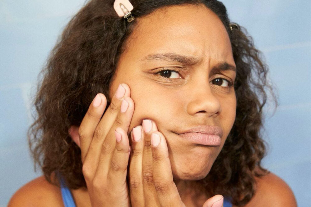 5 acne scarring tips for face & neck.