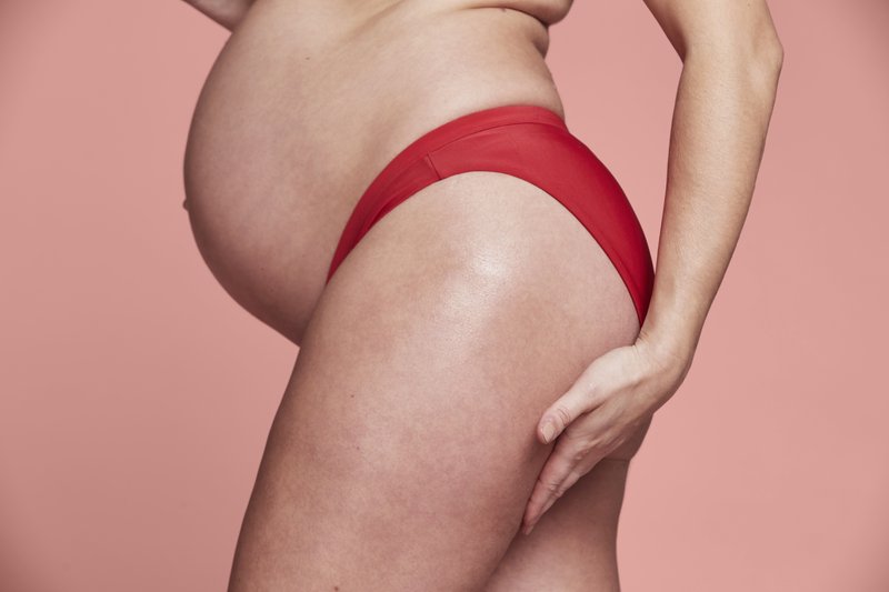 How to treat your pregnancy acne.