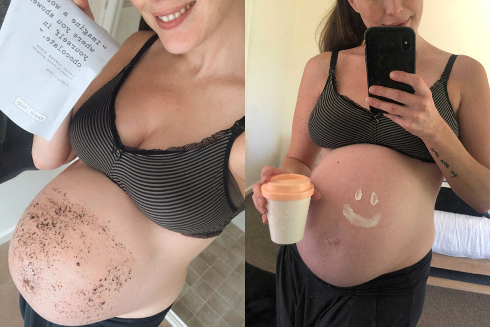 What to do with stretch marks after pregnancy?