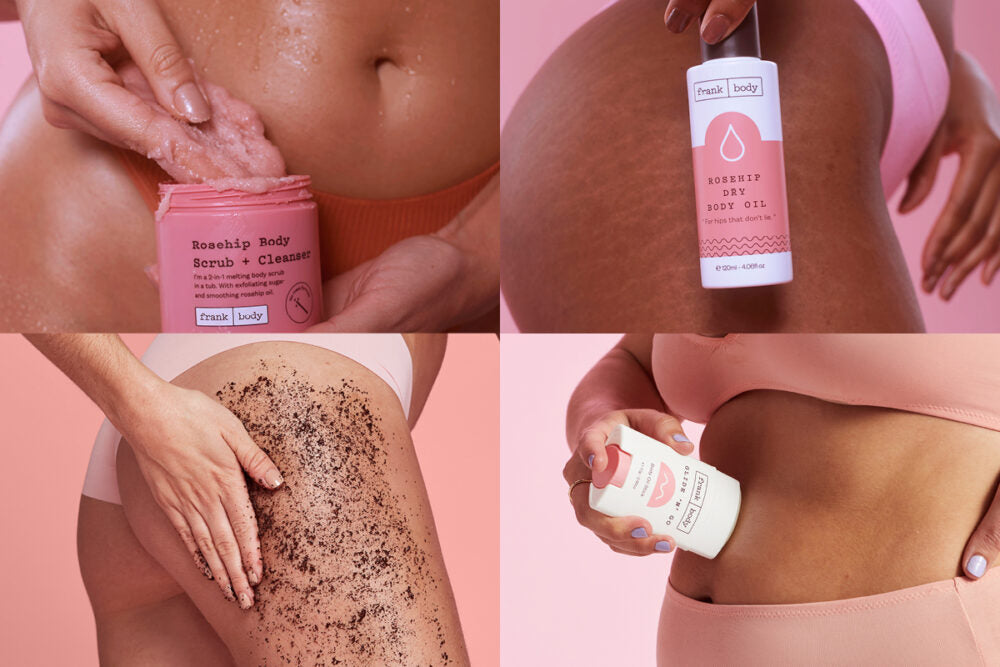 The 4 best products to prevent stretch marks.