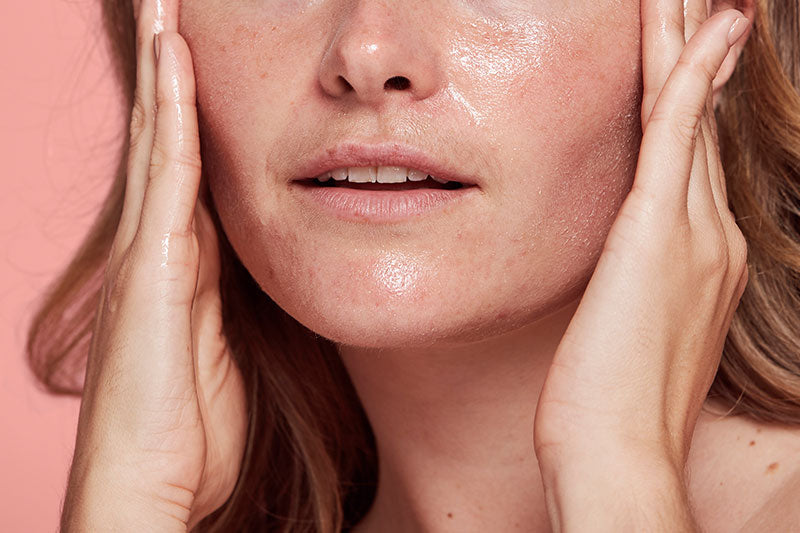 Why oil cleansing can clear your skin.