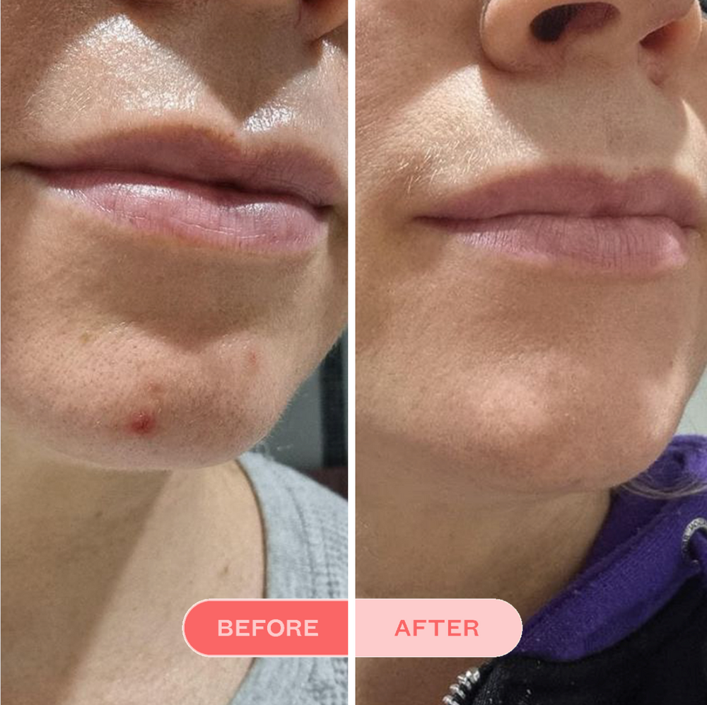 Clearing Face Wash