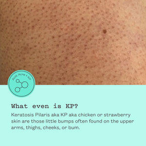 Glycolic Body Scrub