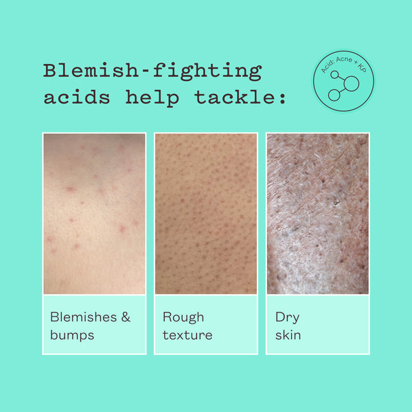 Glycolic Body Scrub