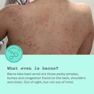 Triple Acid Body Mist